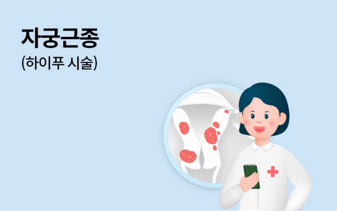 자궁근종(하이푸 시술)